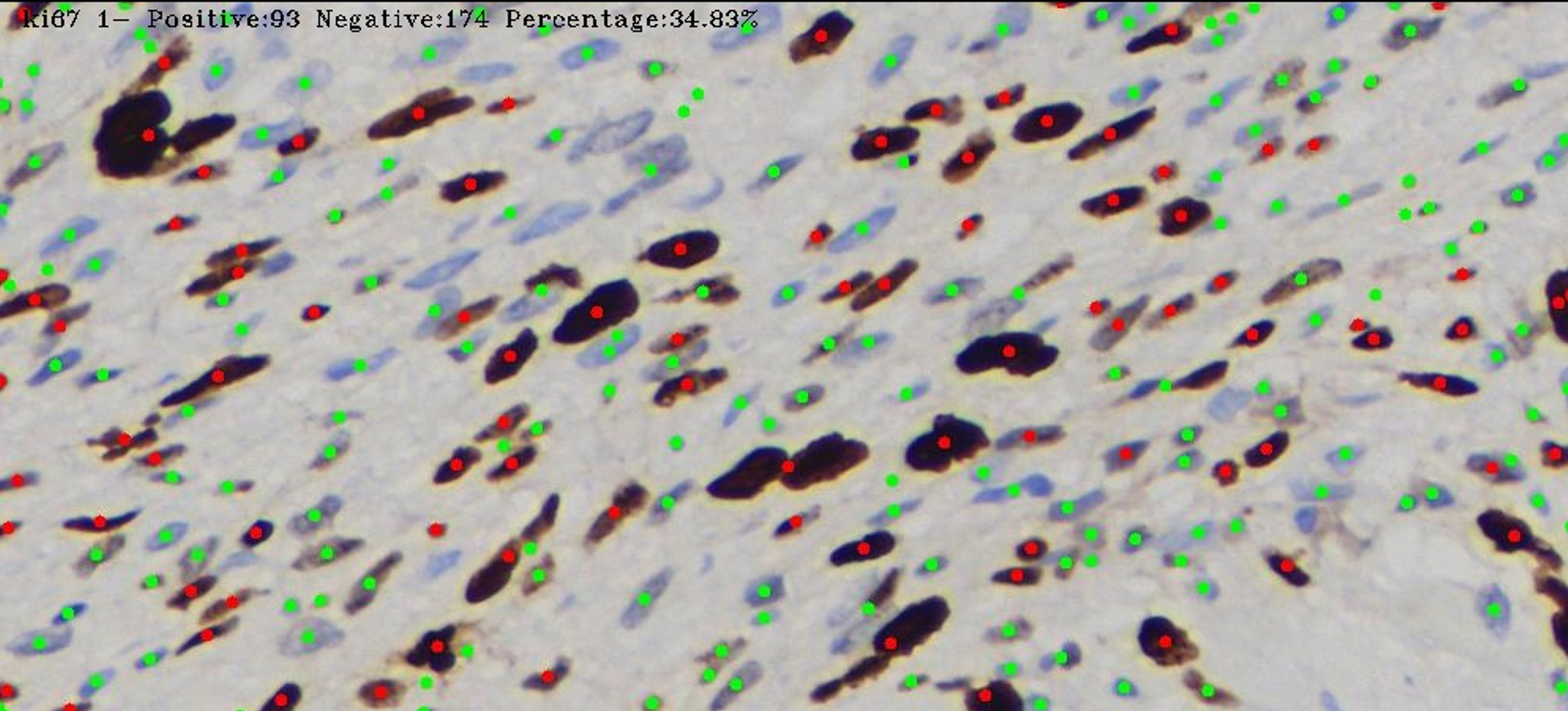 AI-quantified biomarker read